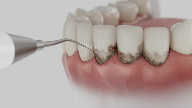 Reliable Dental contractor in Decatur, IN by Dentist Open Now